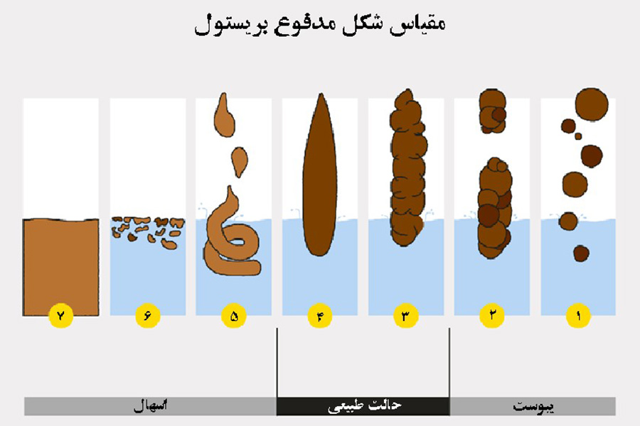 در این مقیاس، اغلب مدفوع نوع 4 (منسجم اما نرم) بهعنوان ایدهآل در نظر گرفته میشود.