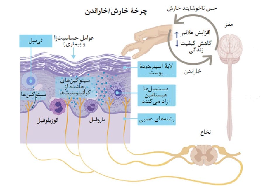 چرخه خارش/خاراندن (یا خارش/خراش) به زمانی اشاره دارد که بیمار، پس از احساس خارش، اقدام به خاراندن محل میکند.