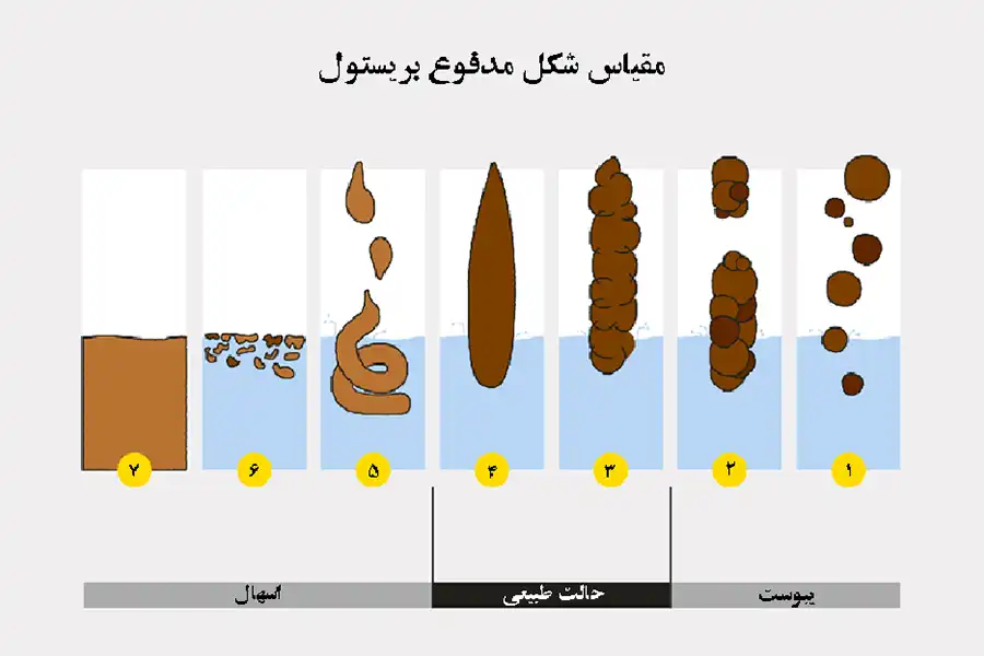 مدفوع نوع 4 (منسجم اما نرم)، بهعنوان مدفوع ایدهآل درنظر گرفته میشود.