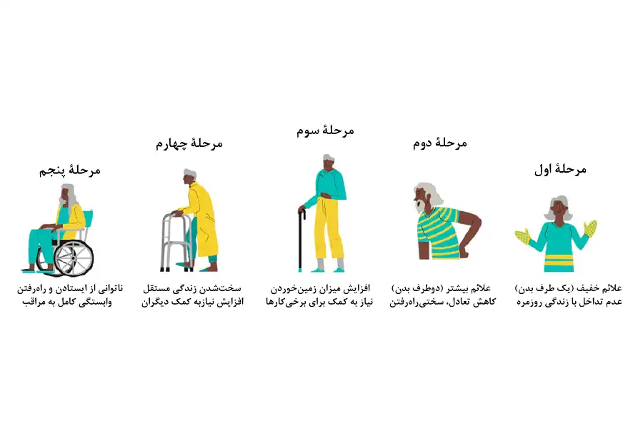 براساس تقسیمبندی انجامشده توسط هوئن و یار (1967)، بیماری پارکینسون 5 مرحله دارد.