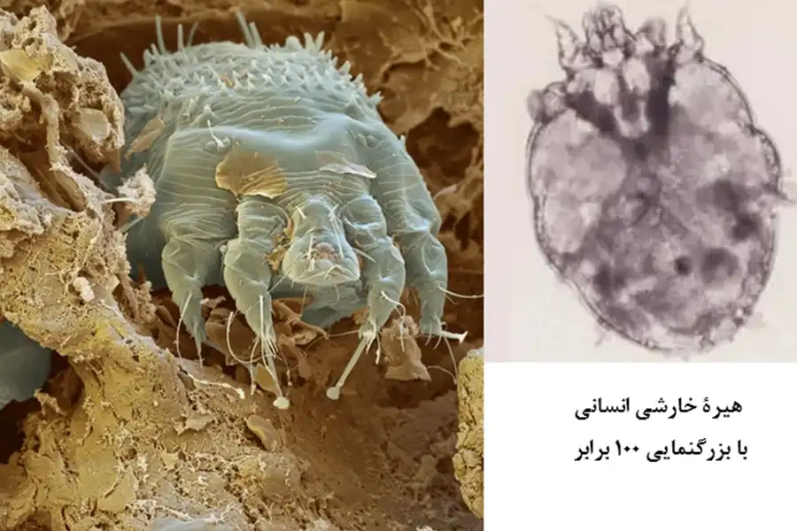 تصویر میکروسکوپی و سهبعدی انگل هیره ماده گال