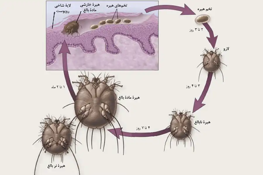 چرخه عمر انگل گال و نحوه ایجاد بیماری